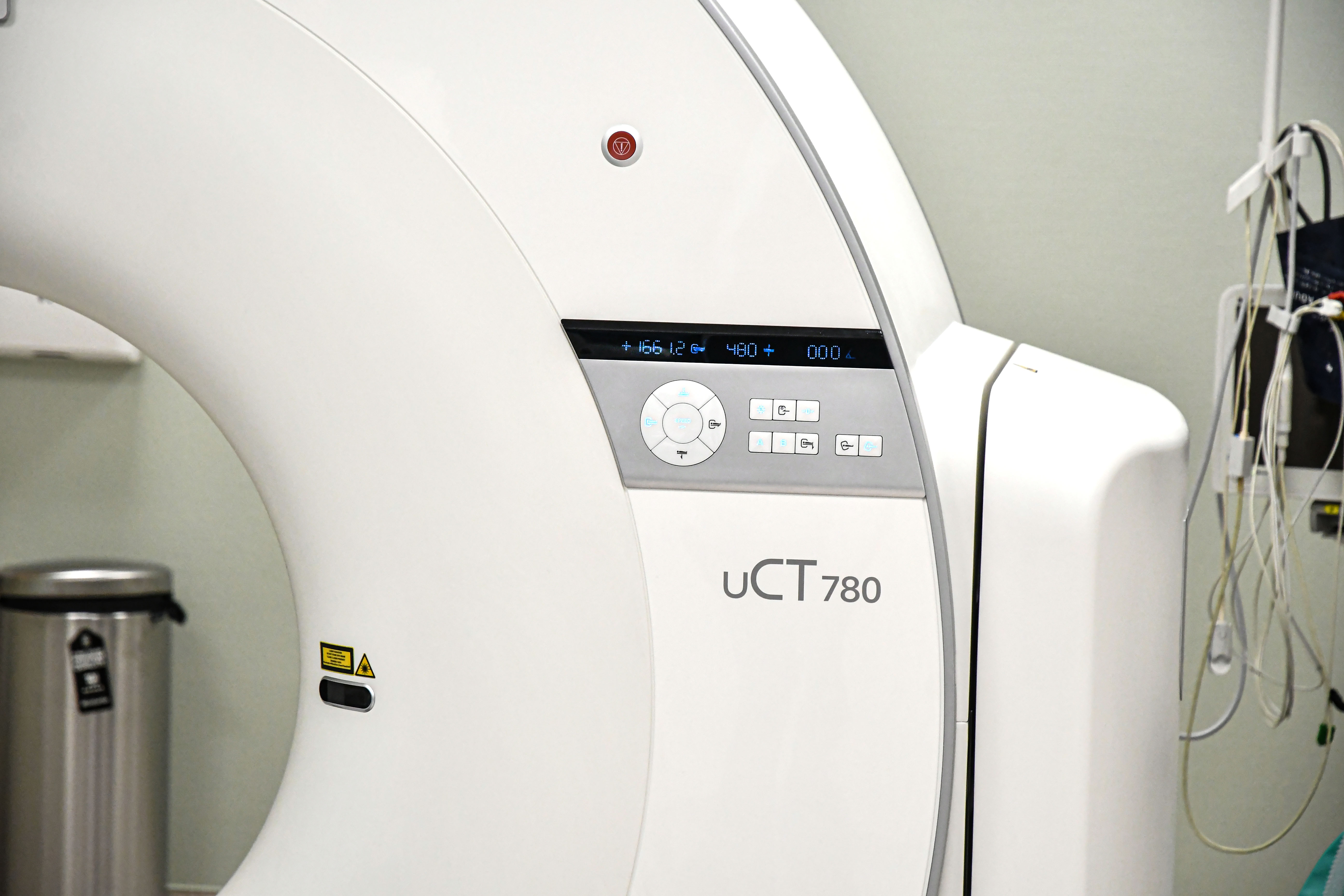 Az új berendezés üzembe helyezésével a sátoraljaújhelyi Erzsébet Kórház diagnosztikai kapacitása jelentősen megerősödött. A fejlesztés nemcsak technológiai előrelépést jelent, hanem a térség lakosságának biztonságát és esélyegyenlőségét is szolgálja – biztosítva, hogy a korszerű ellátás valóban helyben és időben legyen elérhető.