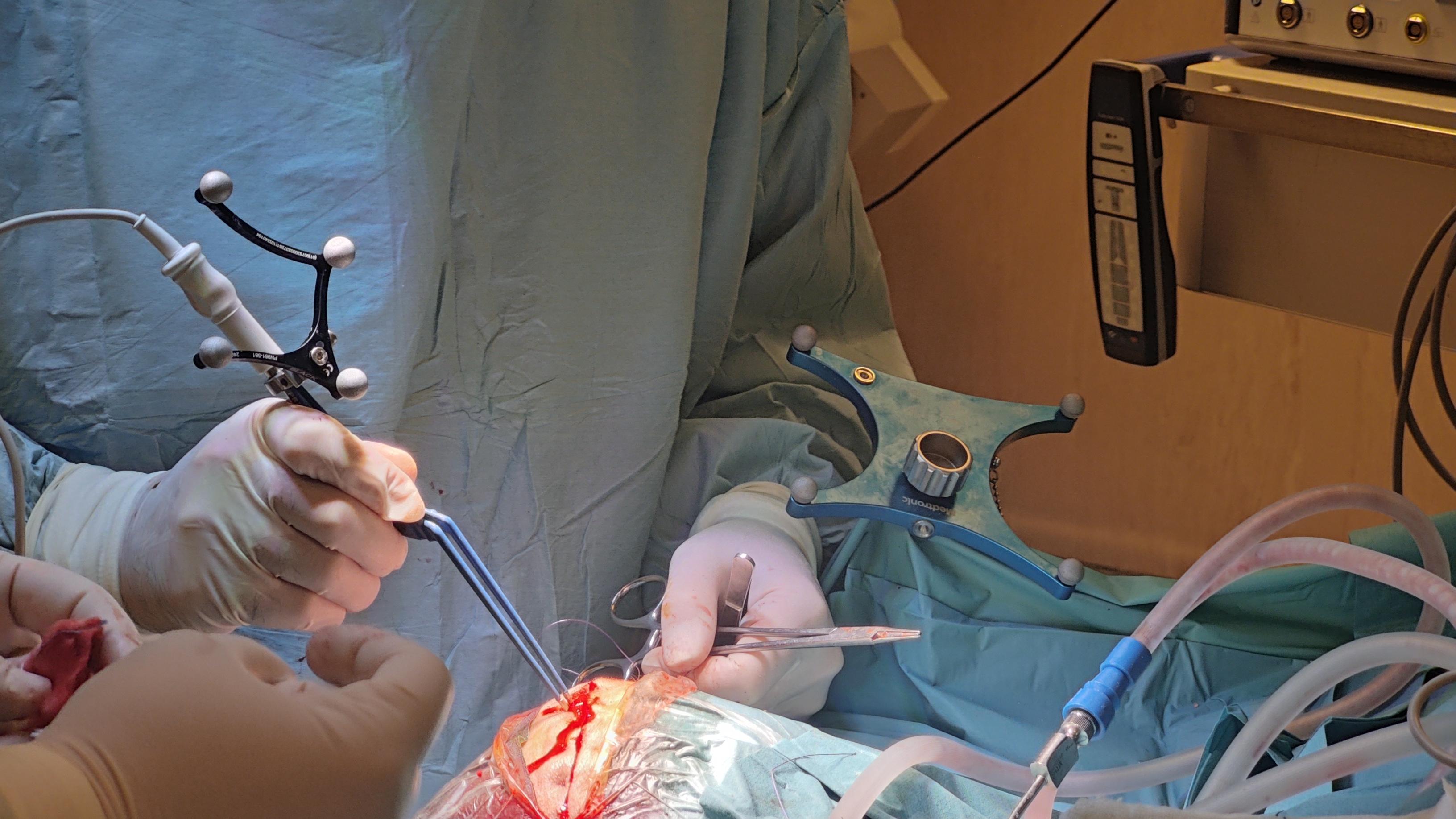 StealthStation S8 használat közben